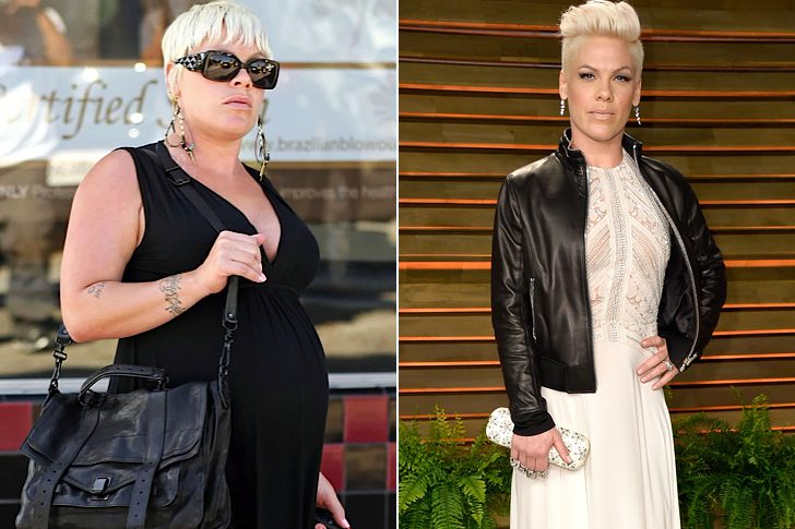 Famous Celebrities Who Splurged on Cosmetic Enhancements – Page 14